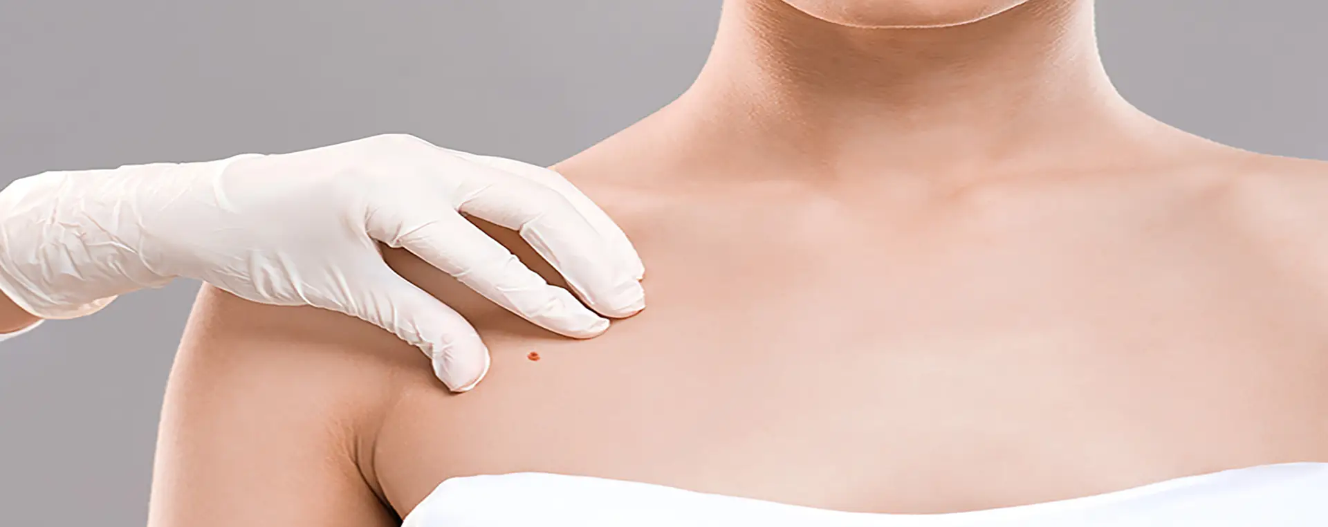 Dermatology examination – mole and skin check